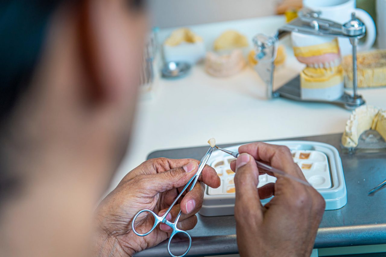 Zahntechnische Detailarbeit an einer Zahnversorgung vor Zahnmodellen
